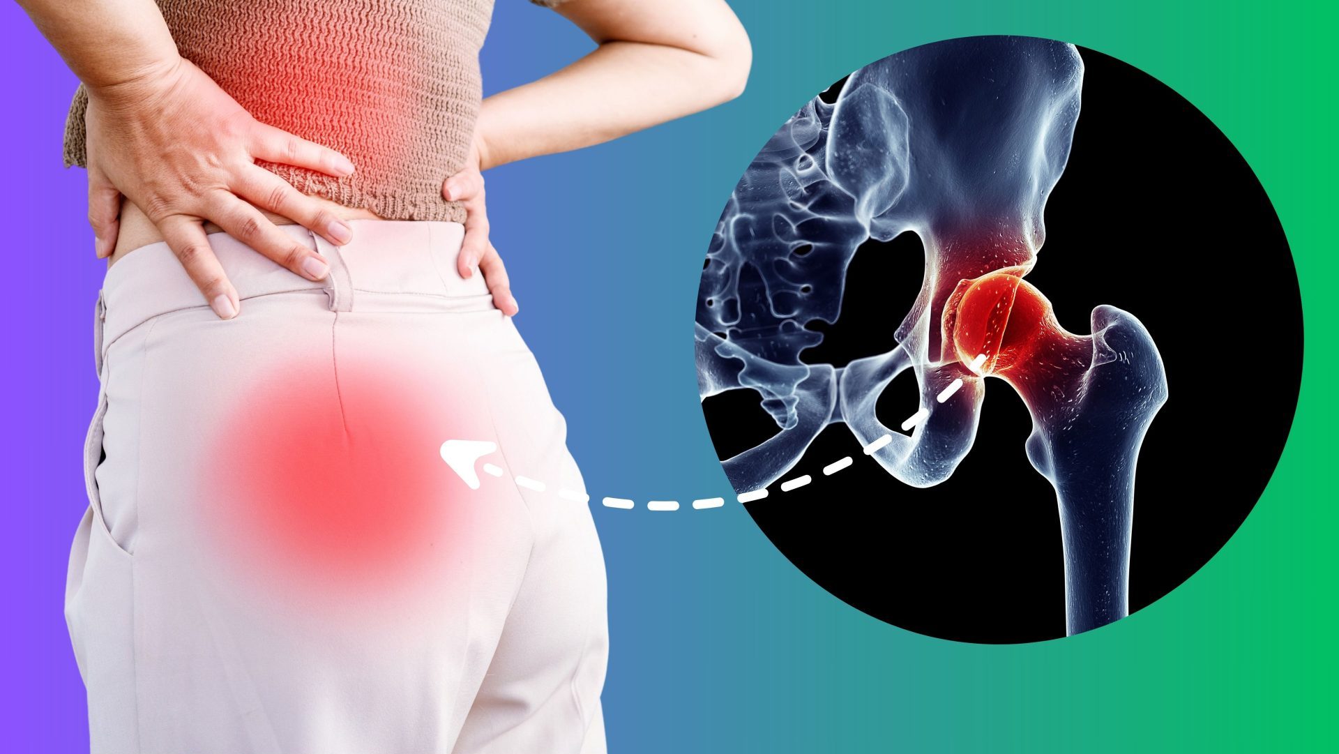 Hüftschmerzen sind kein Schicksal – nimm deine Gesundheit selbst in die Hand